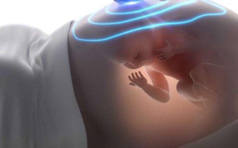 超声排畸到底做二维、三维还是四维？