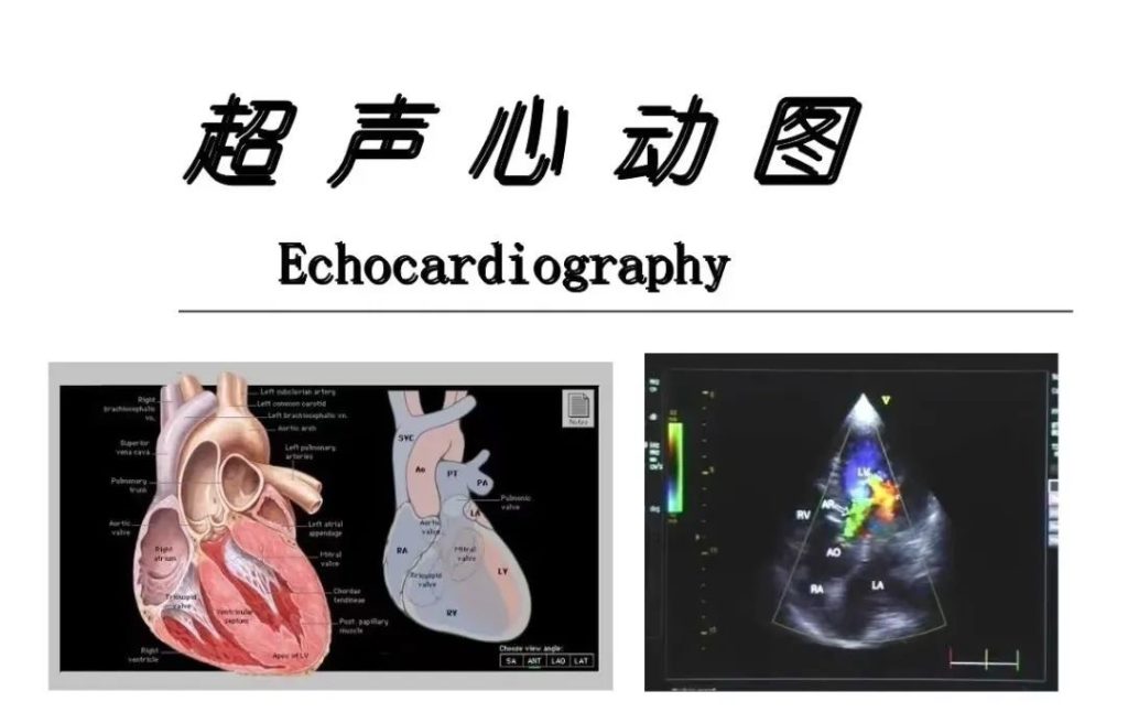 心脏介入术后不可忽视定期复查