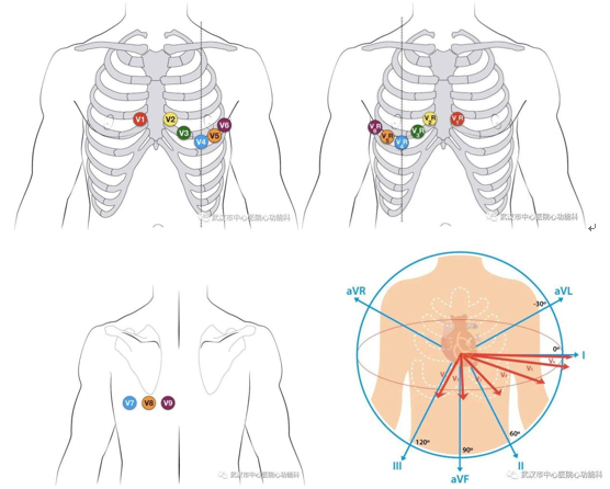 十八导联同步记录心电图——“更多导联、更多信息、更少漏诊”