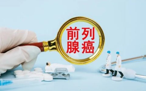 揭秘前列腺癌认识的误区