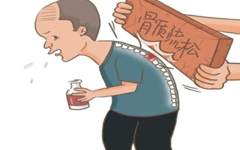 “静悄悄”的健康大问题 —— 骨质疏松
