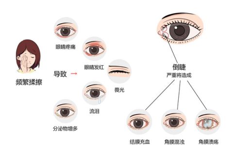 眼皮问题，你想知道的都在这儿