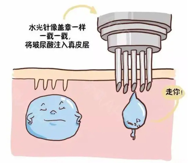 这些水光基础常识的小科普、你知道吗？