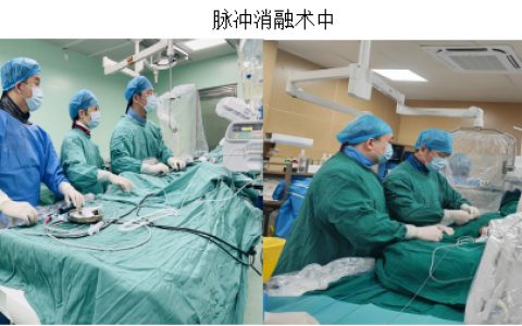 脉冲消融——房颤治疗新武器