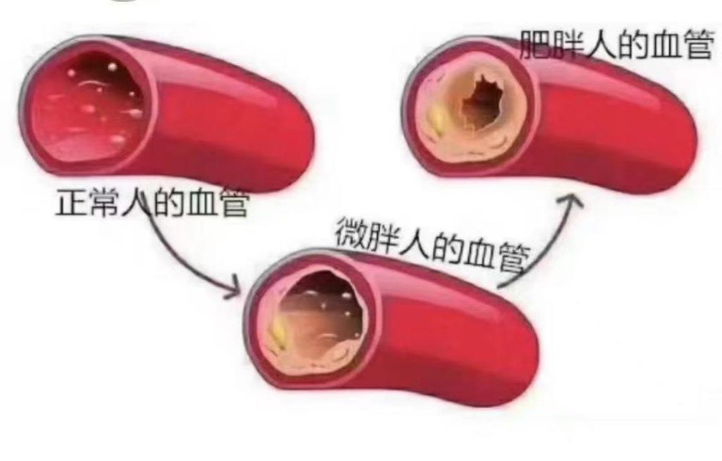 体重管理年：科学减重，给心脏减负！