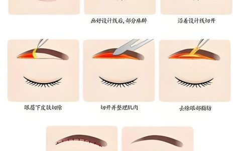 40岁，切眉还是双眼皮？这篇给你答案：抗衰不是“二选一”，是“找回自己”