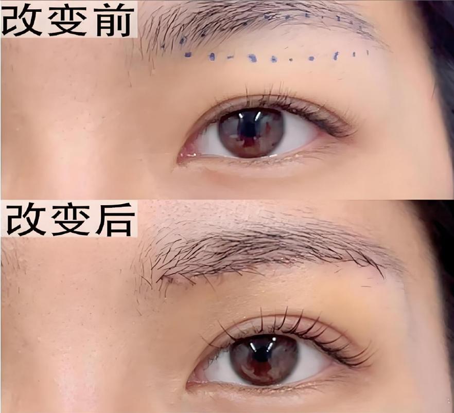 40岁，切眉还是双眼皮？这篇给你答案：抗衰不是“二选一”，是“找回自己”
