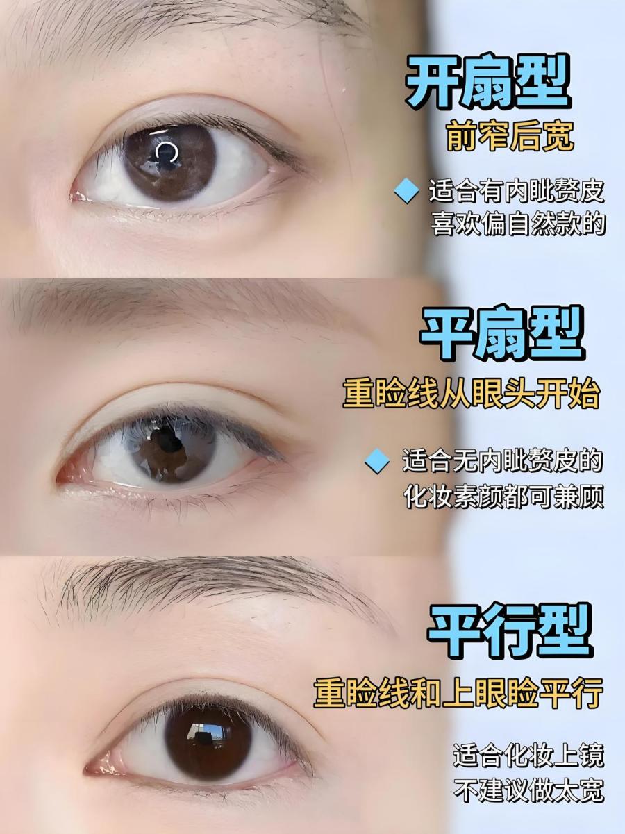 40岁，切眉还是双眼皮？这篇给你答案：抗衰不是“二选一”，是“找回自己”