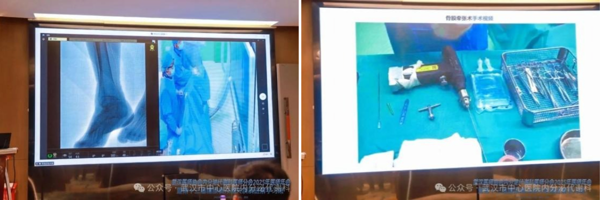 武汉医师协会内分泌代谢科医师分会举办2025年医师年会暨第十三届糖尿病及相关疾病进展学习班