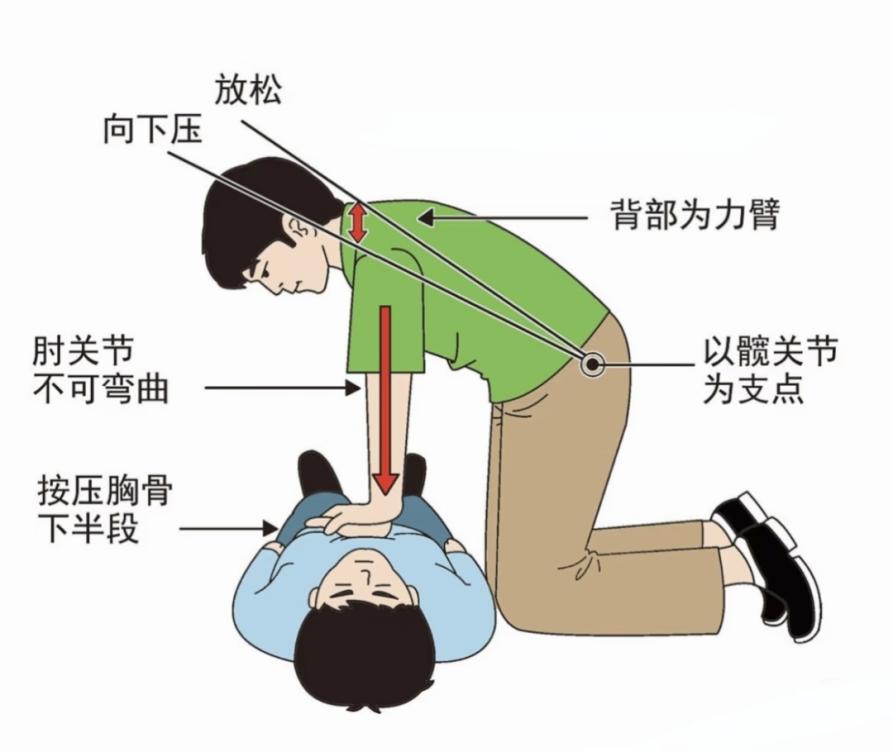 心脏骤停知多少，学会这招能救命