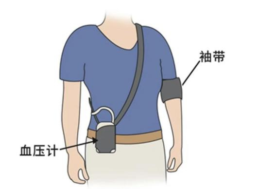 高血压病友必看！家庭血压监测的实用攻略