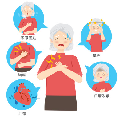冠心病患者科学运动指南