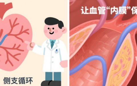 冠心病患者科学运动指南