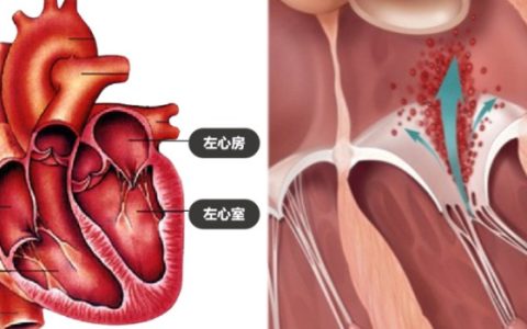 心“门”关不严？微创“夹子”来帮忙！——认识武汉市领航技术：TEER手术