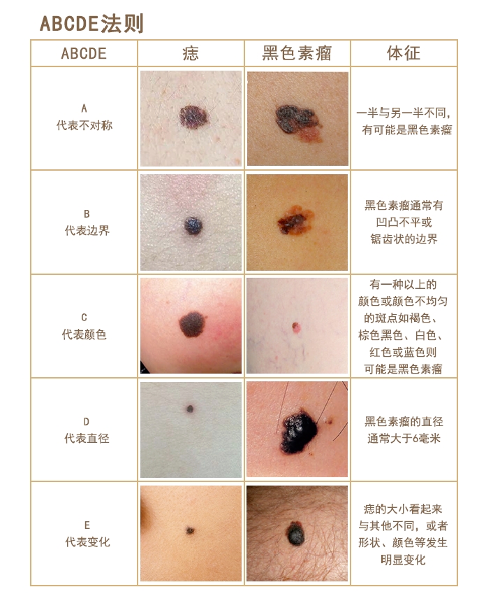 体表肿瘤:了解你皮肤上的“小疙瘩”