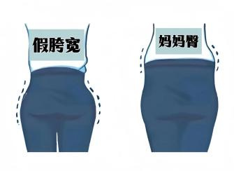 告别“顽固”脂肪?吸脂术全解析——关于吸脂,你想知道的在这里
