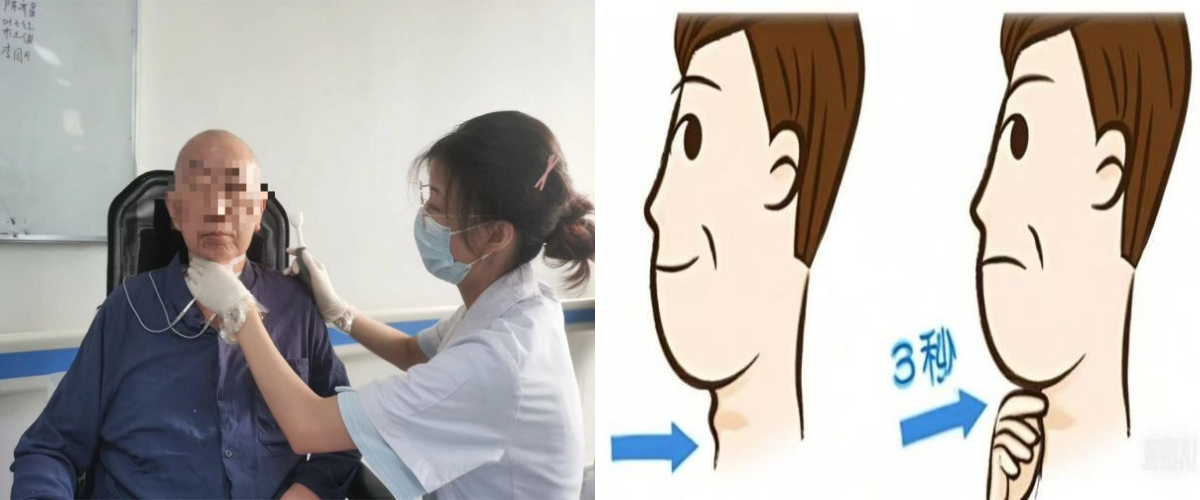 吞咽有道,康复有方:汉医康复的吞咽治疗“杀手锏”